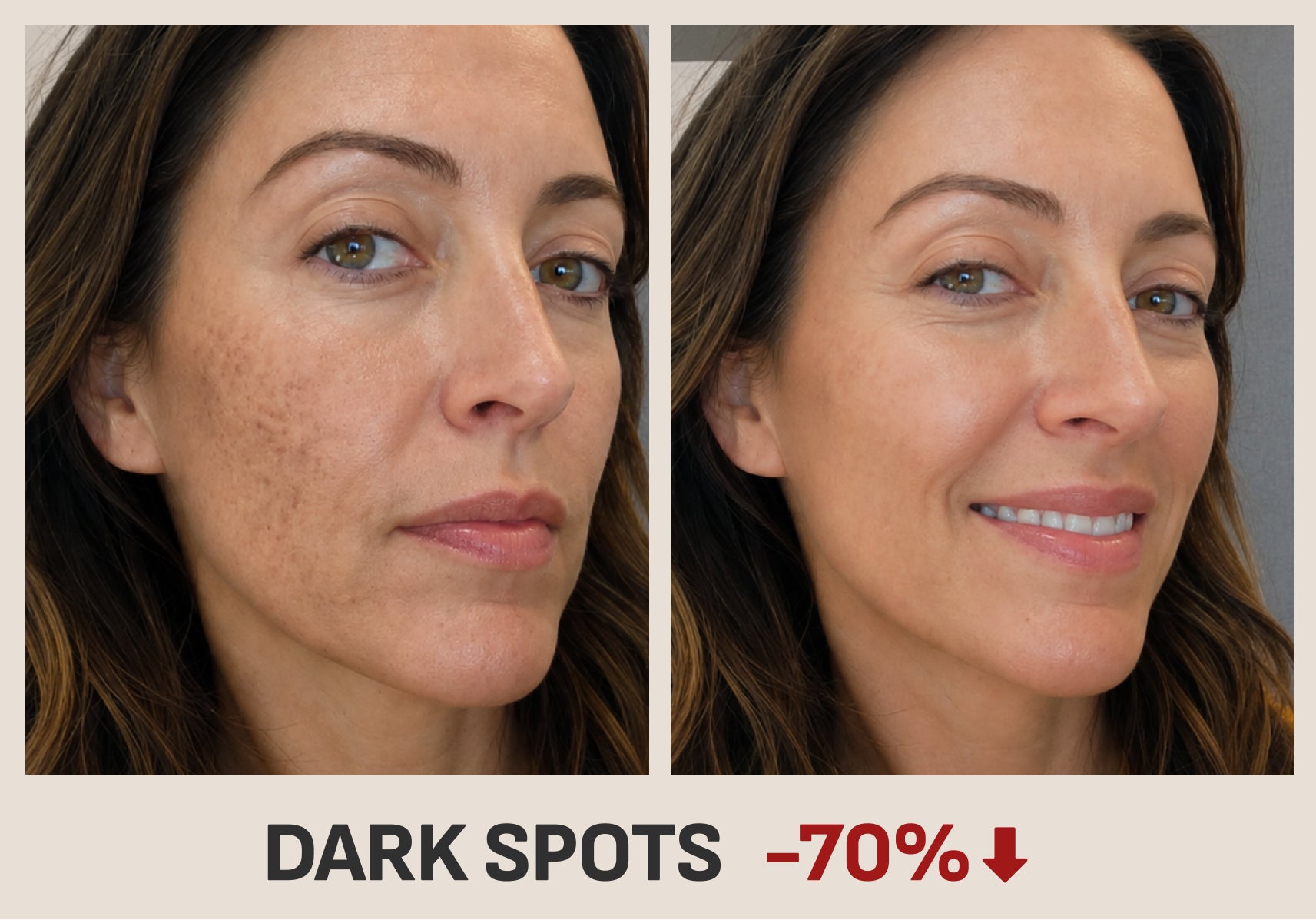 4. Fades Dark Spots & Old Scars