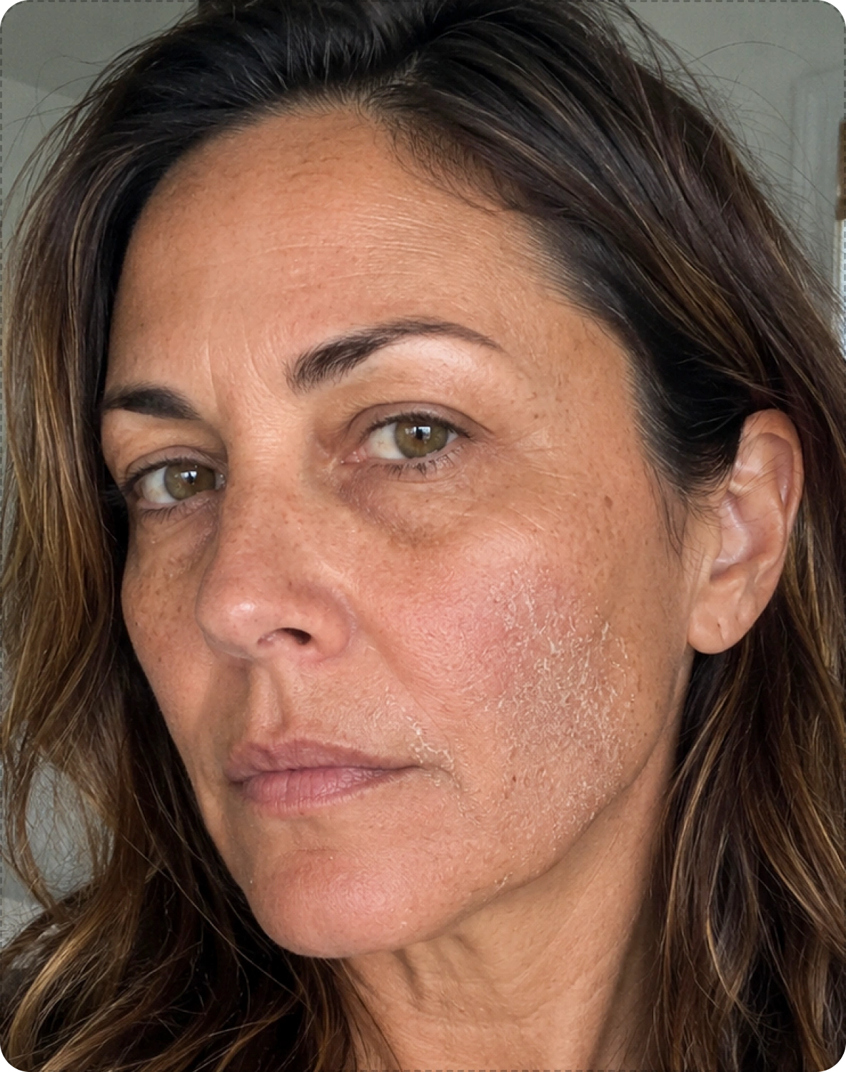 Before using Glacier Naturals Face Balm