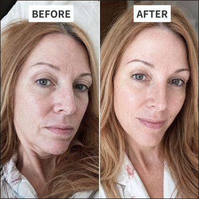Woman touching soft hydrated skin